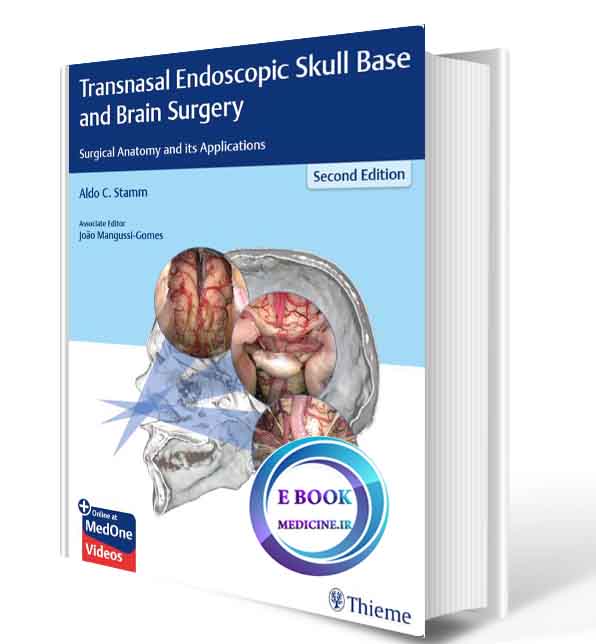 دانلود کتابTransnasal Endoscopic Skull Base and Brain Surgery: Surgical Anatomy and its Applications 2019(ORIGINAL PDF)  